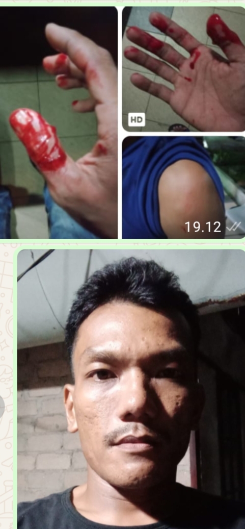 Kasus Penganiayaan di Cafe Golden Memory Dilaporkan ke Polisi, Korban Alami Luka Serius